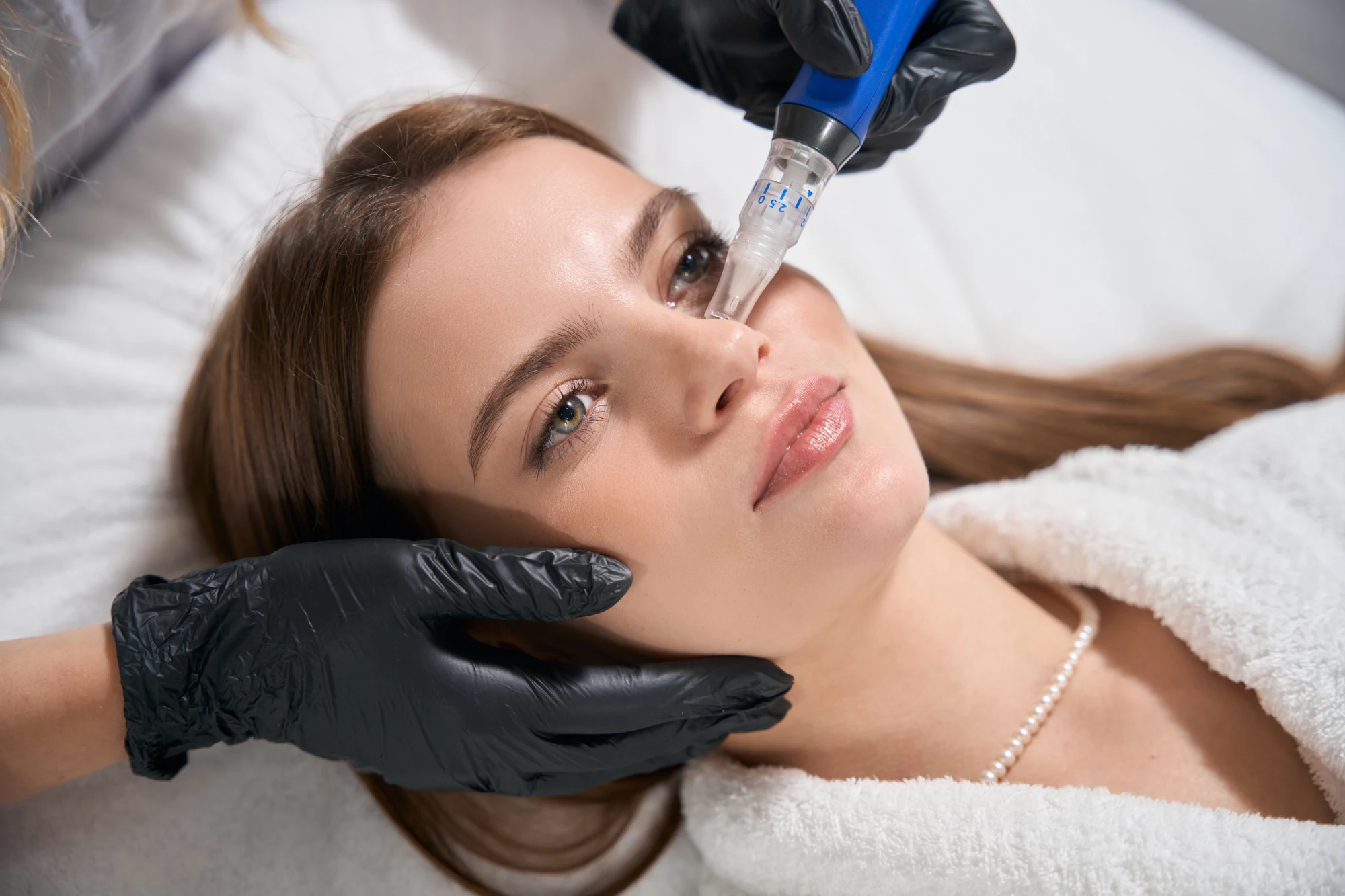 SkinPen® Microneedling in Oro Valley, AZ